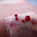 Gotas de sangre